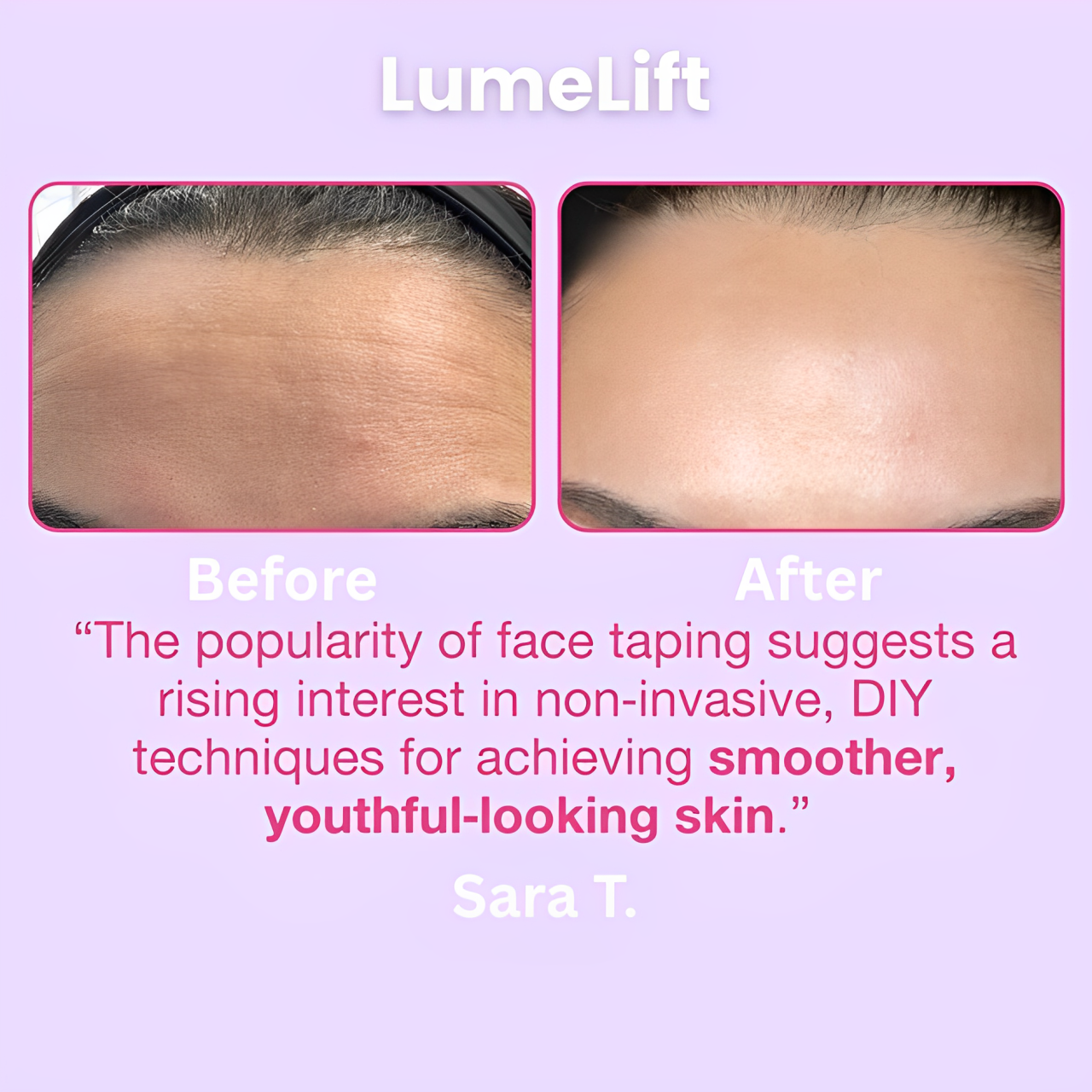 LumeLift™️ Anti Wrinkle Patches